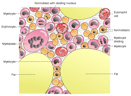Дефицит железа