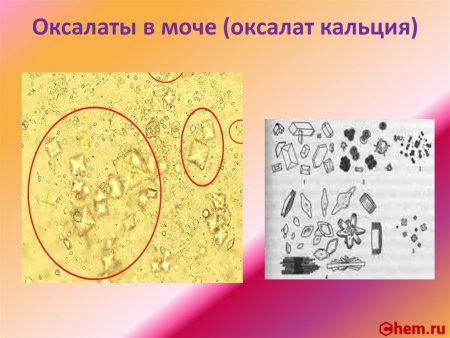 Оксалат кальция